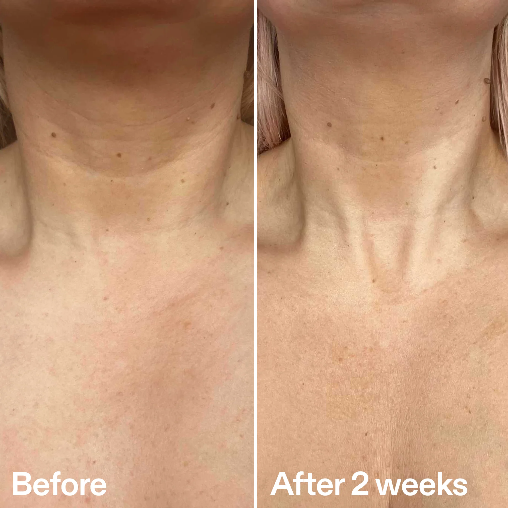 Bio-Active Neck Lift Stick - Image 7