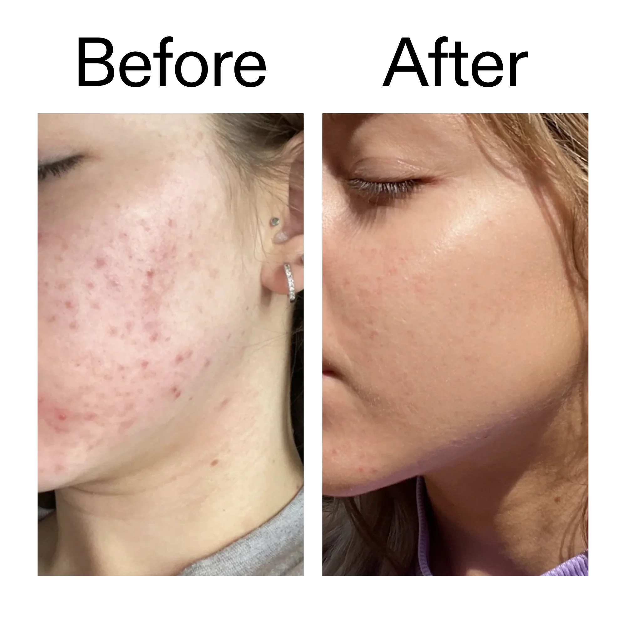 10% Niacinamide Serum Duo - Image 8