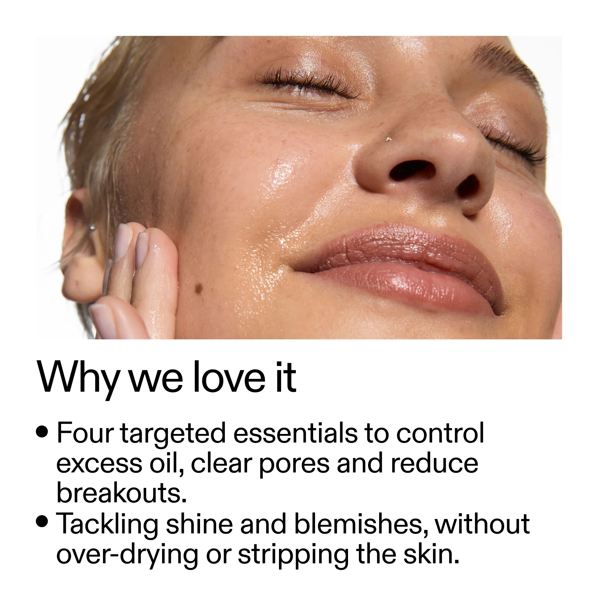 Oily Blemish-Prone Skin Routine - Image 4