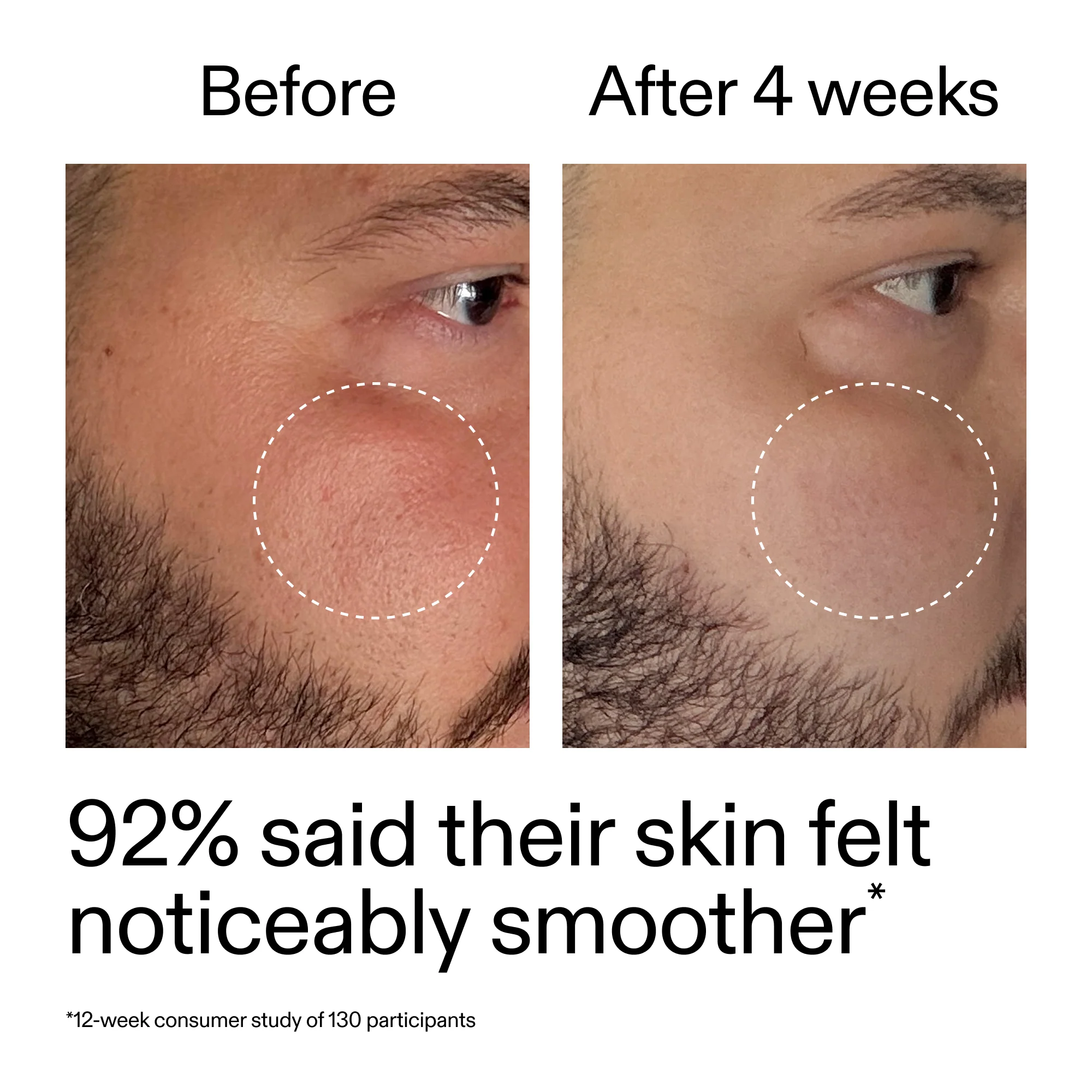 Starter Retinol Serum Duo - Image 11