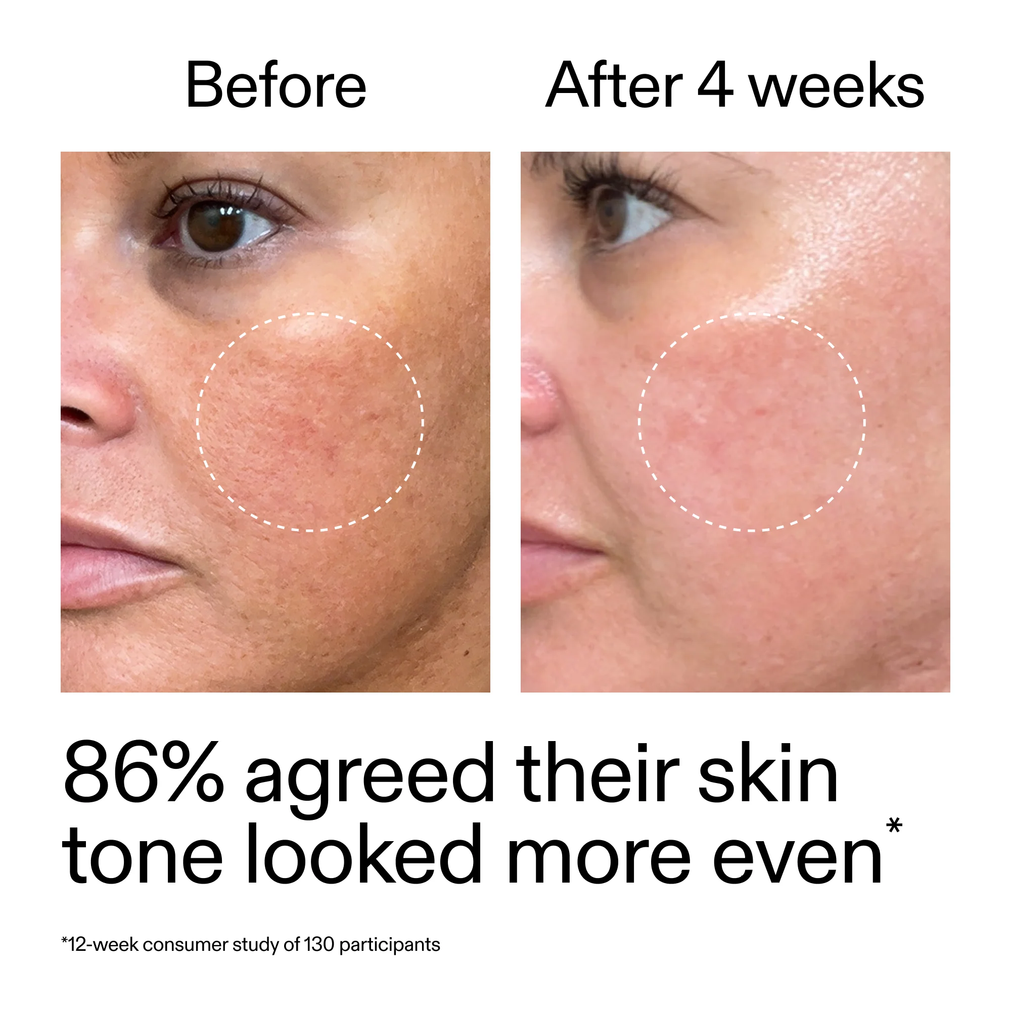 Starter Retinol Serum Duo - Image 12